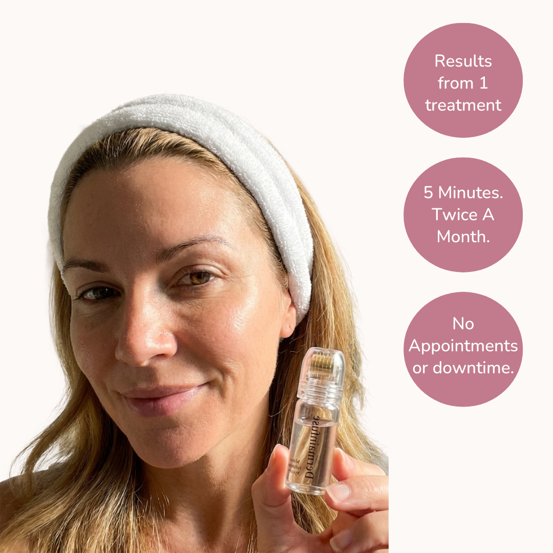 DermaInfuse™ Micro-Infusion System