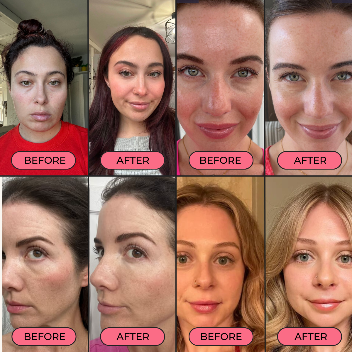 LumiGlow™ Red Light Under-Eye Therapy