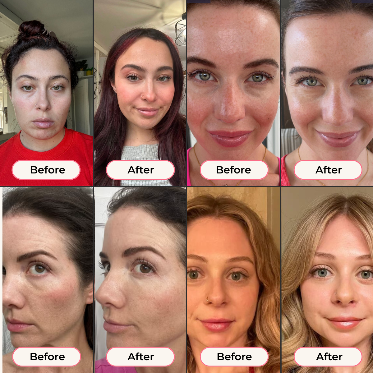 LumiGlow™ Red Light Under-Eye Therapy