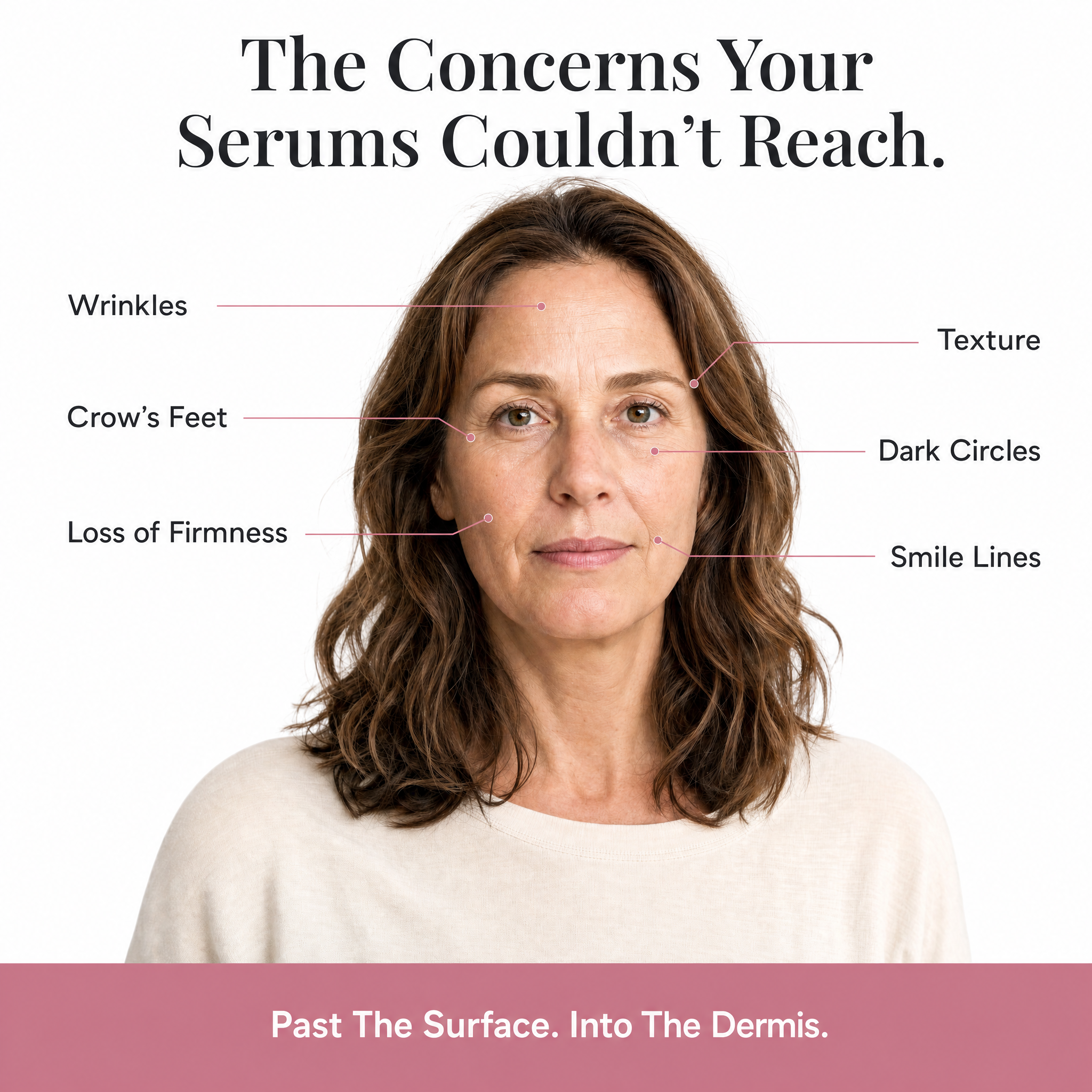 DermaInfuse™ Micro-Infusion System
